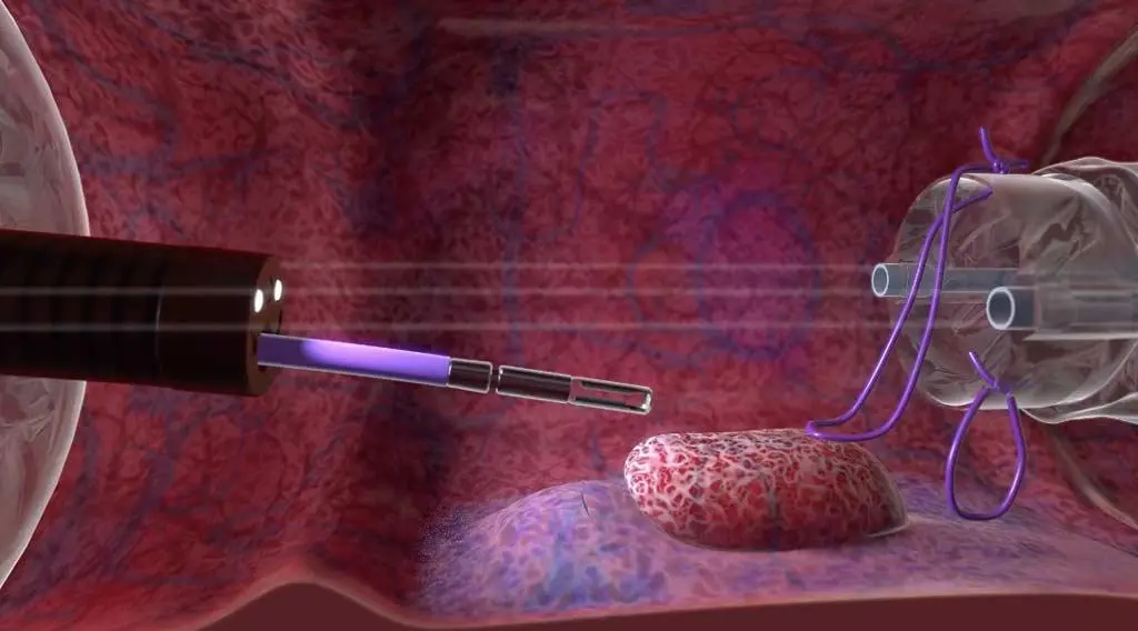 medical 3d animation image2 asquarefx studios